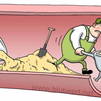 Cholesterin im Blut und die Beseitigung