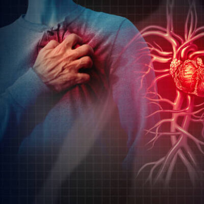Cholesterin und wie man hohe Werte ins sinken bringen kann.