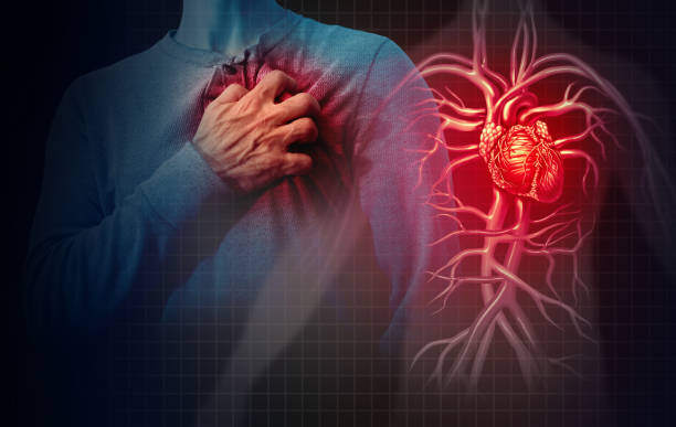 Cholesterin und wie man hohe Werte ins sinken bringen kann.