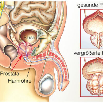 Ich begrüße immer meine Freunde mit Prostata kommt von Prost und tata.